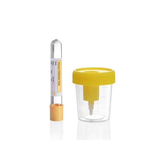 kit-provetta-esami-urine